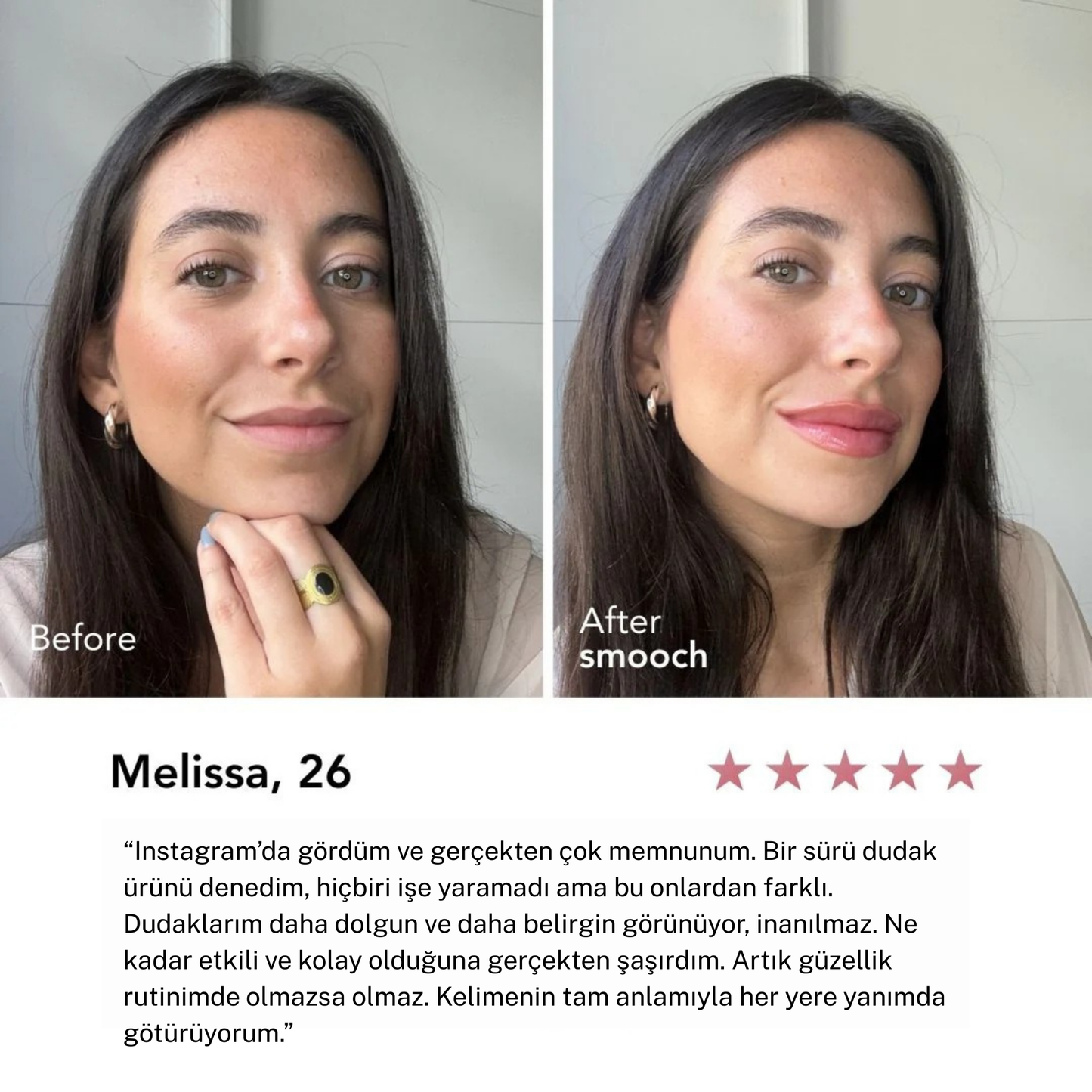 Smooch® Dudak Dolgunlaştırıcı ve Parlatıcı
