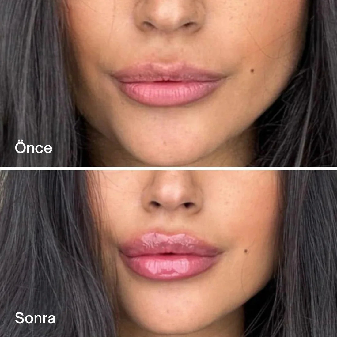 Smooch® Dudak Dolgunlaştırıcı ve Parlatıcı